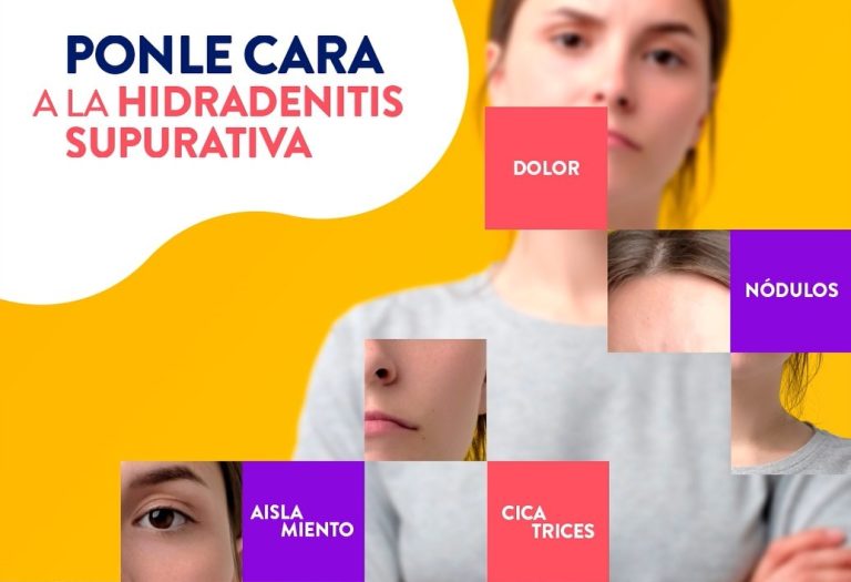 «PONLE CARA A LA HS», la nueva campaña de ASENDHI y Novartis para identificar y visualizar la Hidradenitis Supurativa.