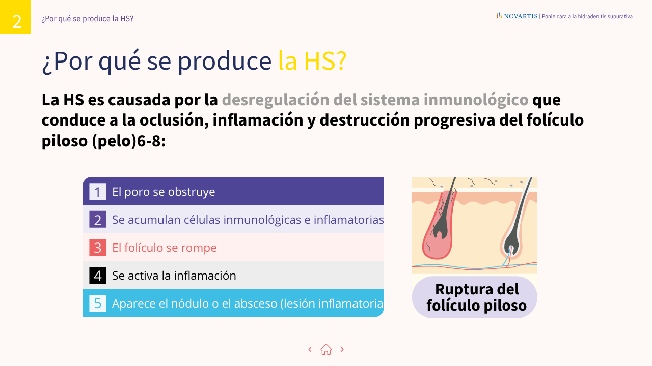 Pagina2-Folleto-Guia-Hidradenitis-Supurativa-Pacientes-Asendhi