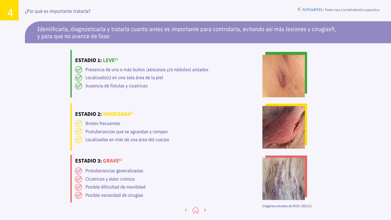 Pagina4-Folleto-Guia-Hidradenitis-Supurativa-Pacientes-Asendhi